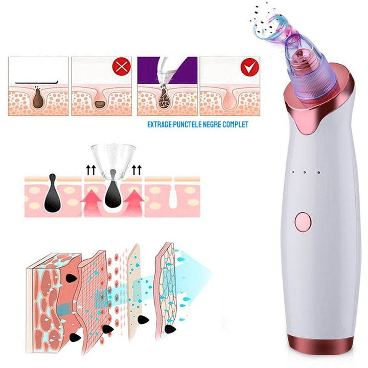 Aspirator Profesional pentru Puncte Negre – 5 Capete, Putere Mare de Absorbție, Încărcare USB, Curățare Ten & Eliminare Acnee